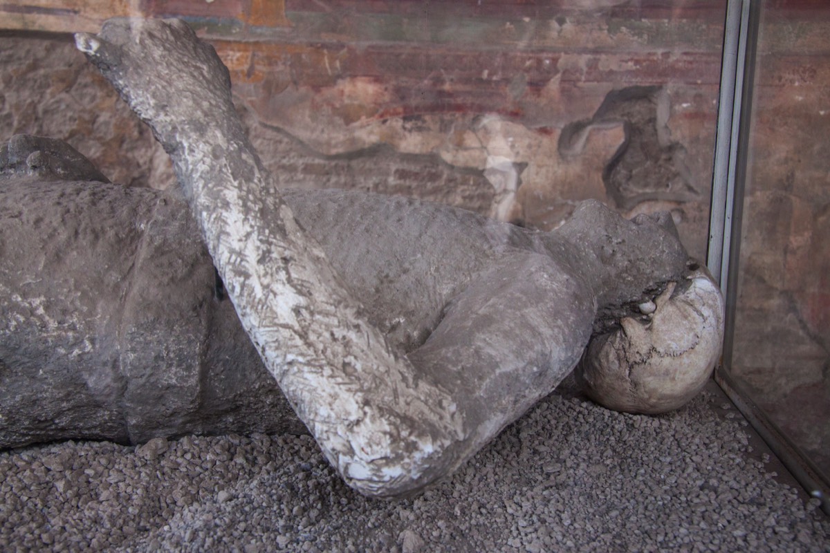 Plaster cast of a person, parts of the skeleton  as a bonus